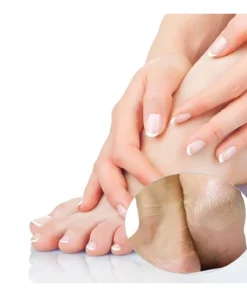 Foot Care